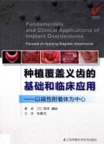 种植覆盖义齿的基础和临床应用 以磁性附着体为中心