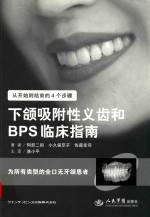 下颌吸附性义齿和BPS临床指南