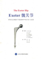 骨水泥全髋关节置换40年的历史与发展 Exeter 髋关节