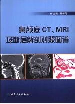 鼻颅底CT、MRI及底断层解剖对照图谱