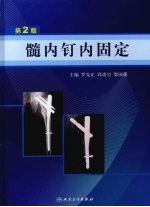 髓内钉内固定