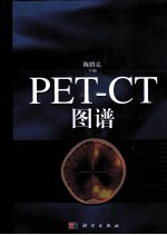 PET-CT图谱