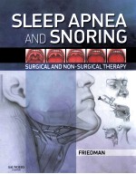 SLEEP APNEA AND SNORING SURGICAL AND NON-SURGICAL THERAPY