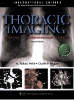 THORACIC IMAGING PULMONARY AND CARDIOVASCULAR RADIOLOGY SECOND EDITION