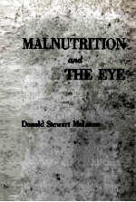 Malnutrition and the eye