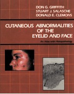 CUTANEOUS ABNORMALITIES OF THE EYELID AND FACE