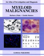 MYELOID MALIGNANCIES