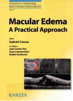 MACULAR EDEMA A PRACTICAL APPROACH