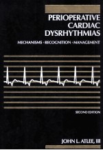 PERIOPERATIVE CARDIAC DYSRHYTHMIAS MECHANISMS