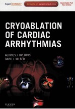 Cryoablation of Cardiac Arrhythmias