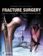 HARBORVIEW IIIUSTRATED TIPS AND TRICKS IN FRACTURE SURGERY