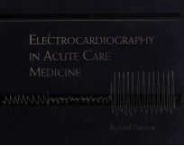 Electrocardiography in acute care medicine