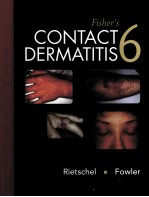 FISHER'S CONTACT DERMATITIS 6