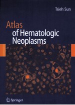 Atlas of Hematologic Neoplasms