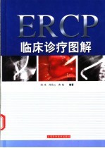 ERCP临床诊疗图解