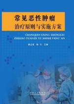 常见恶性肿瘤治疗原则与实施方案