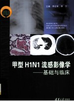 甲型H1N1流感影像学 基础与临床