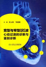 宽型与窄型QRS波心动过速的诊断与鉴别诊断