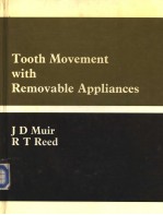 Tooth Movement with Removable Appliances