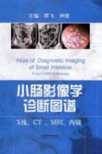 小肠影像学诊断图谱 X线、CT、MRI、内镜