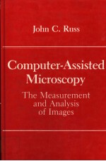 COMPUTER-ASSISTED MICROSCOPY THE MEASUREMENT AND ANALYSIS OF IMAGES