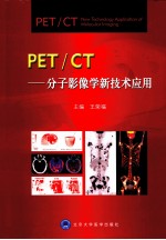 PET/CT 分子影像新技术应用