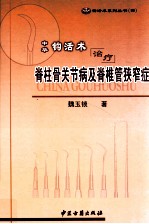 中华钩活术治疗脊柱骨关节病及脊椎管狭窄症