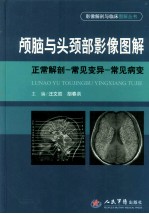 颅脑与头颈部影像图解 正常解剖-常见变异-常见病变