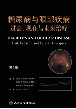 糖尿病与眼部疾病 过去、现在与未来治疗