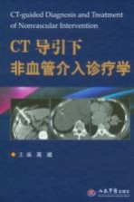 CT导引下非血管介入诊疗学