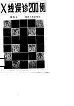 x线误诊200例