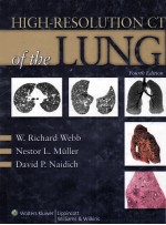 High-Resolution CT of the Lung FOURTH EDITION