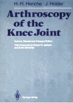 arthroscopy of the knee joint