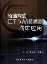 颅脑病变CT与MR对比临床应用