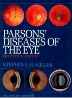 Diseases of the eye; Parsons' diseases of the eye.