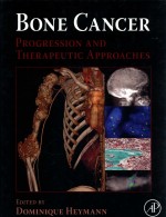 Bone cancer : progression and therapeutic approaches