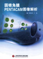 圆锥角膜PENTACAM图像解析