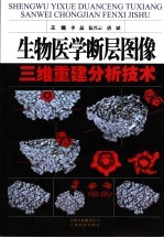 生物医学断层图像 三维重建分析技术