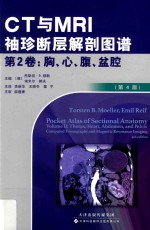 CT与MRI袖珍断层解剖图谱  第2卷  胸、心、腹、盆腔