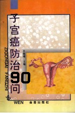 子宫癌防治90问