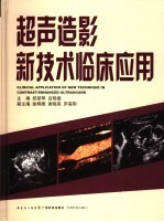超声造影新技术临床应用