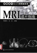 MRI读片指南