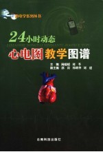 24小时动态心电图教学图谱