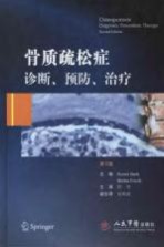 骨质疏松症 诊断、预防、治疗