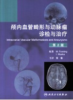 颅内血管畸形与动脉瘤诊检与治疗 原书第2版 诊检与治疗