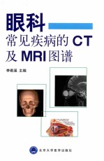 眼科常见疾病的CT及MRI图谱