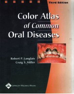 COLOR ATLAS OF COMMON ORAL DISEASES THIRD EDITION