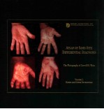 ATLAS OF SAME-SITE DIFFERENTIAL DIAGNOSES VOLUME 1:HANDS AND UPPER EXTREMITIES