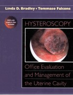 HYSTEROSCOPY:OFFICE EVALUATION AND MANAGEMENT OF THE UTERINE CAVITY