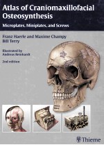 ATLAS OF CRANIOMAXILLOFACIAL OSTEOSYNTHESIS:MICROPLATES